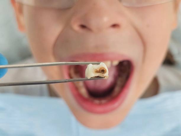 Best Same-Day Emergency Dental Services in Rio, VA